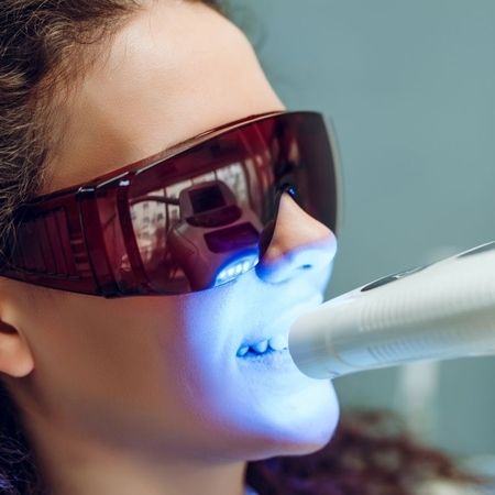 Frau mit Schutzbrille bei einer kosmetischen Zahnaufhellung mit LED-Licht in Zahnarztpraxis
